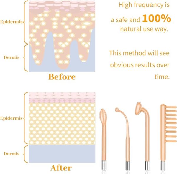 how to use mysweety portable facial wand for high frequency treatment