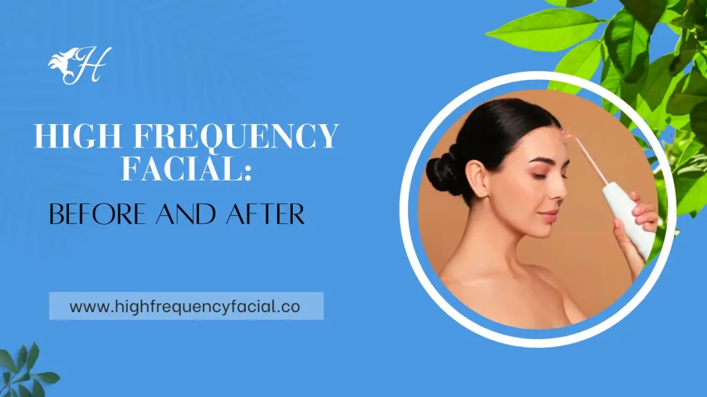 high frequency facial before and after