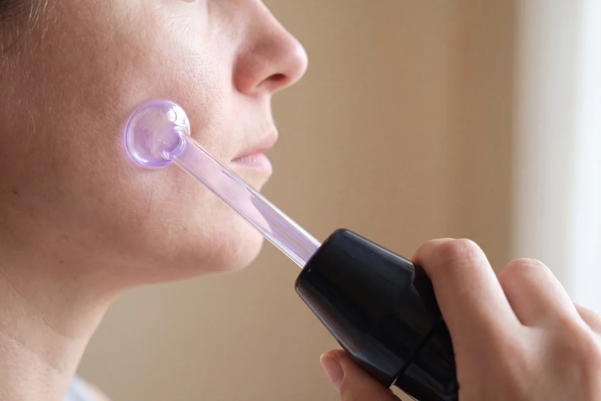 Mushroom electrode on an argon high frequency wand glowing violet as it glides across the middle of a cheek